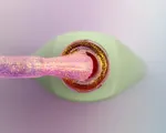 5ml