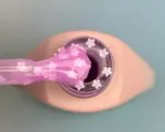 5ml