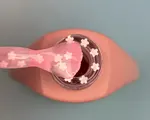 5ml