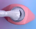 5ml
