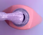 5ml